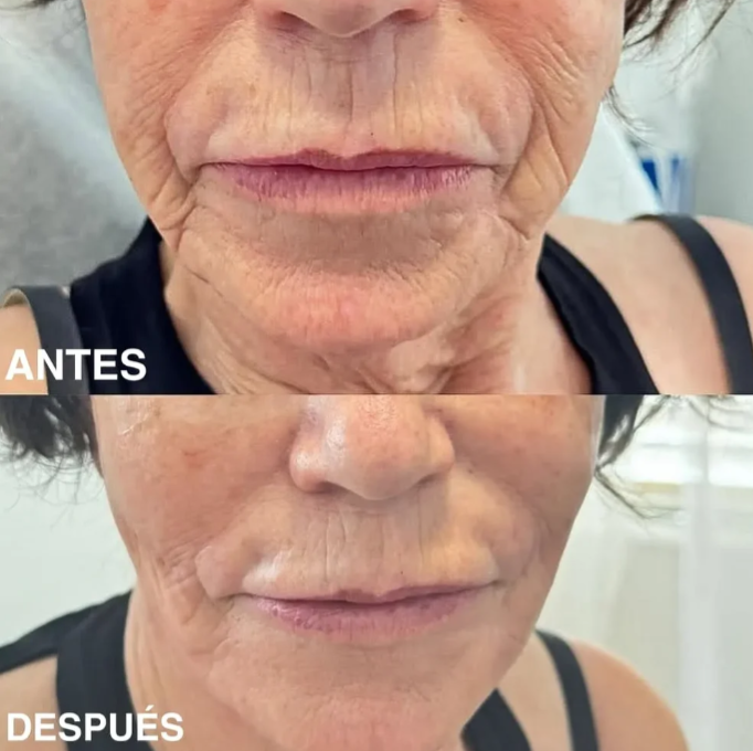 Bálsamo Medicube PDRN Pink Collagen