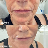 Bálsamo Medicube PDRN Pink Collagen